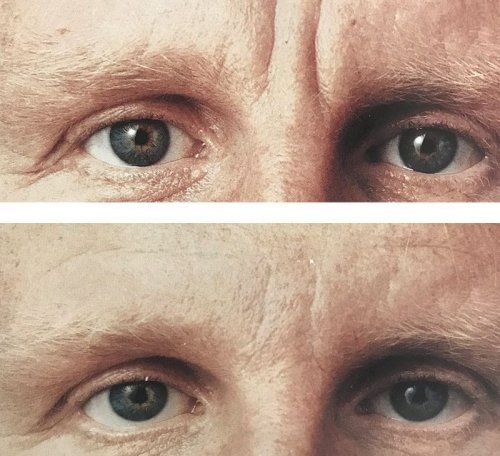 Clínica de estética en Valladolid Clínica de estética en Valladolid