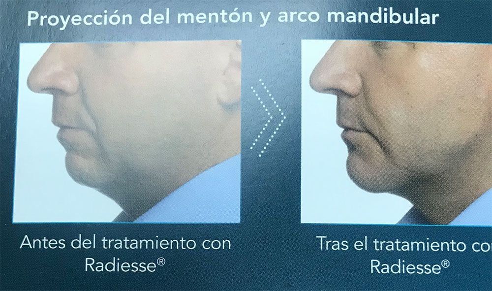 Fotos de tratamientos de estética Fotos de tratamientos de estética