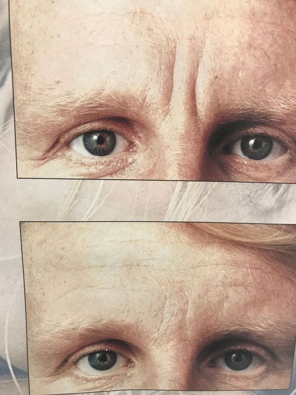 Fotos de tratamientos de estética Fotos de tratamientos de estética