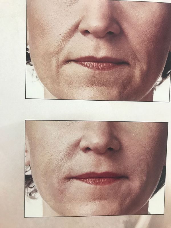 Fotos de tratamientos de estética Fotos de tratamientos de estética