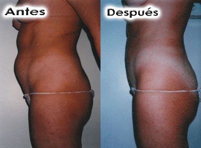 Fotos de tratamientos de estética Fotos de tratamientos de estética