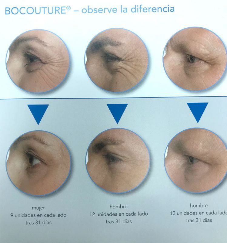 Fotos de tratamientos de estética Fotos de tratamientos de estética