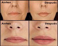 Fotos de tratamientos de estética Fotos de tratamientos de estética