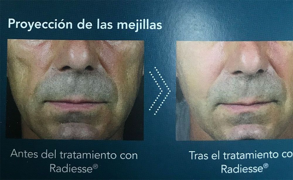 Fotos de tratamientos de estética Fotos de tratamientos de estética